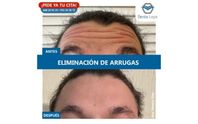 Medicina estética. Eliminación de arrugas